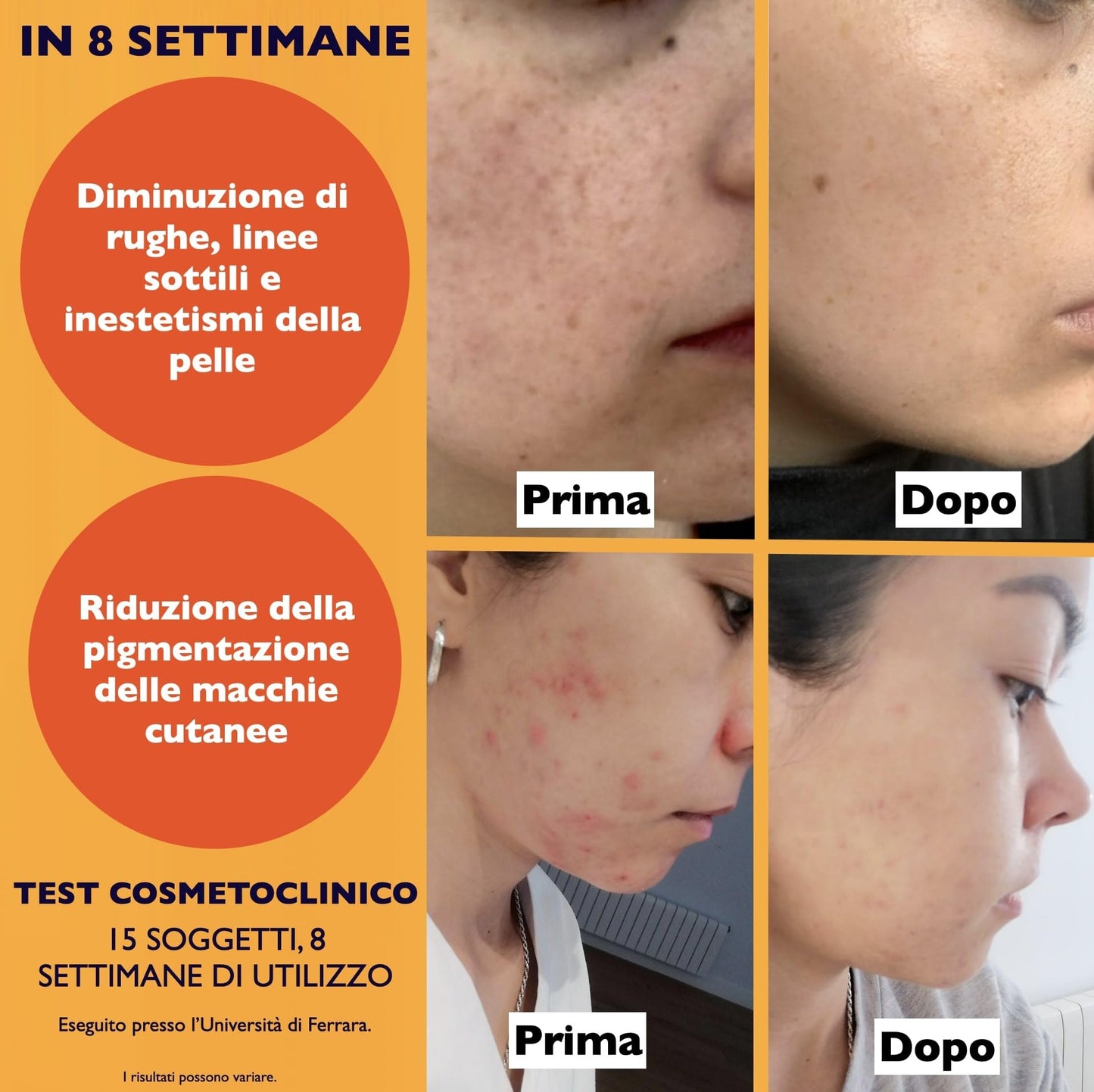 60ml. Bio Siero Vitamina C e Vit. E. Siero Viso Acido Ialuronico Antirughe, Antimacchie Illuminante, e Antietà. Ideale Come Crema Contorno Occhi e per Dermaroller. Biologico,Vegano